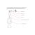 kryza-anty-kondensacyjna-bertrams-parkanex-1.webp